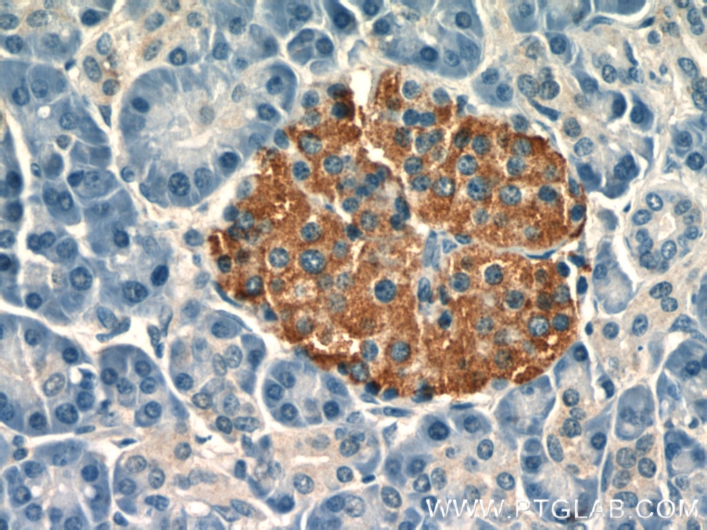 Immunohistochemistry (IHC) staining of human pancreas tissue using MGEA5 Polyclonal antibody (14711-1-AP)