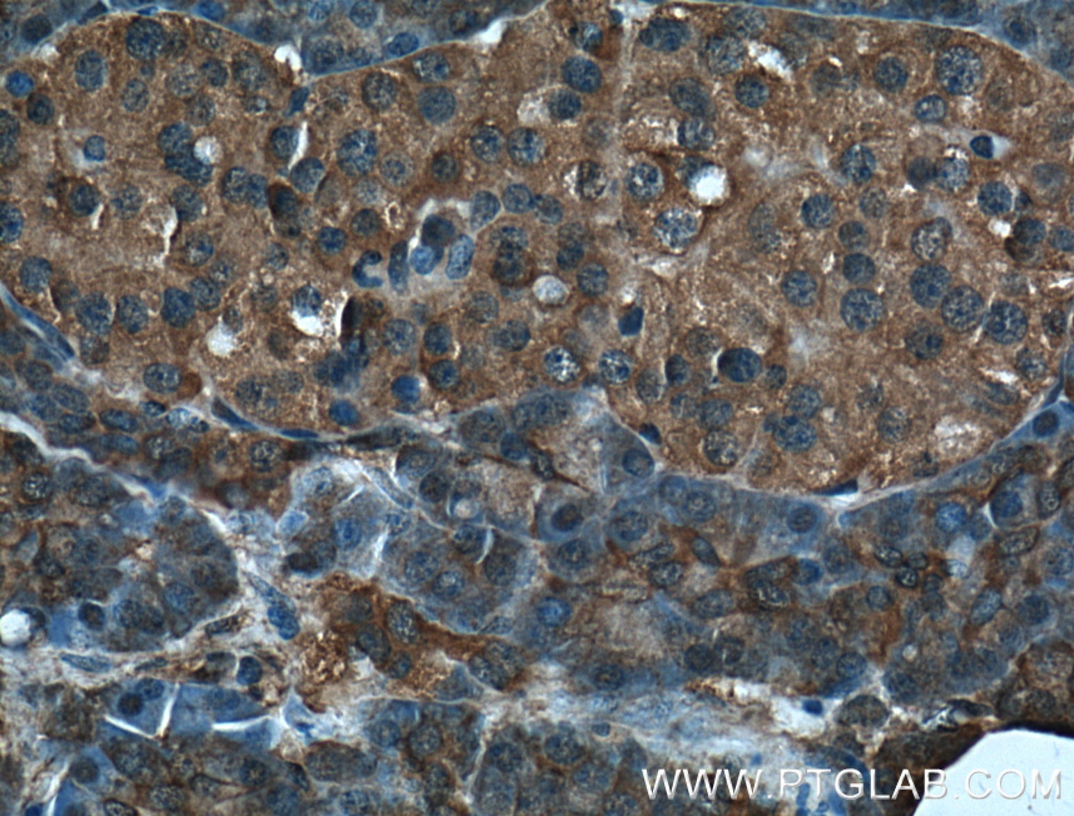 Immunohistochemistry (IHC) staining of human pancreas tissue using MGEA5 Polyclonal antibody (14711-1-AP)