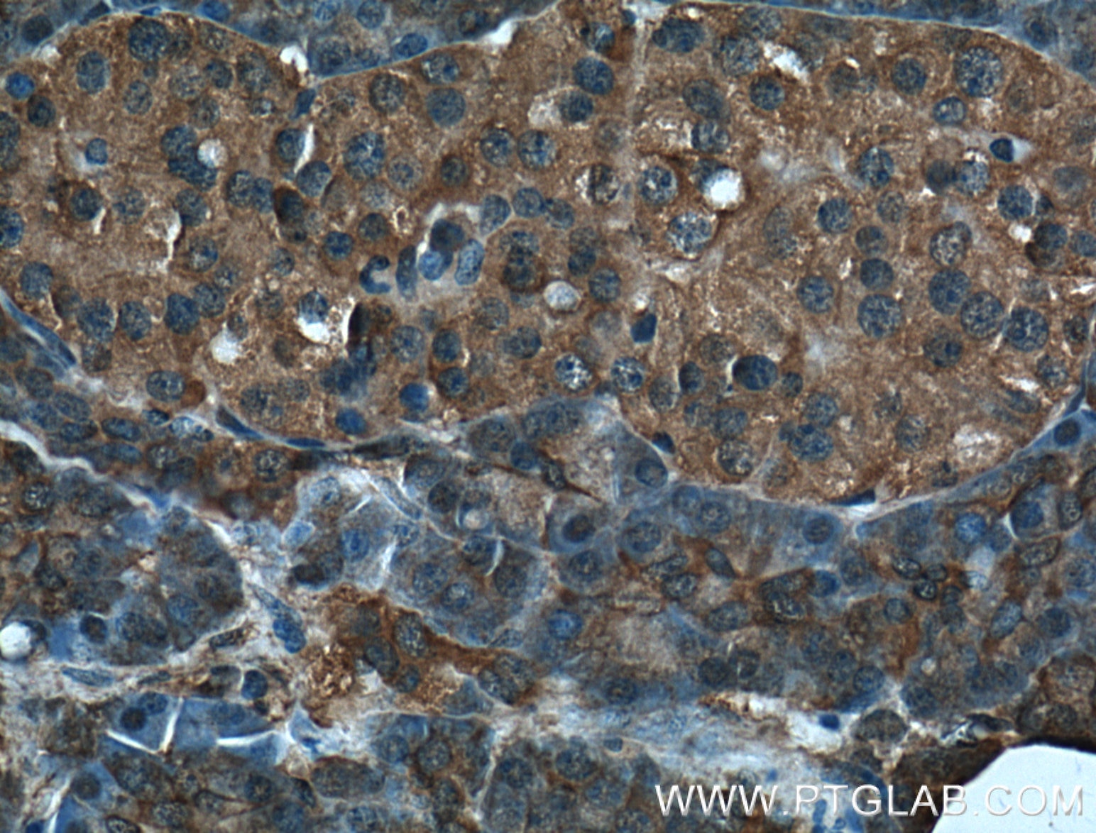 IHC staining of human pancreas using 14711-1-AP