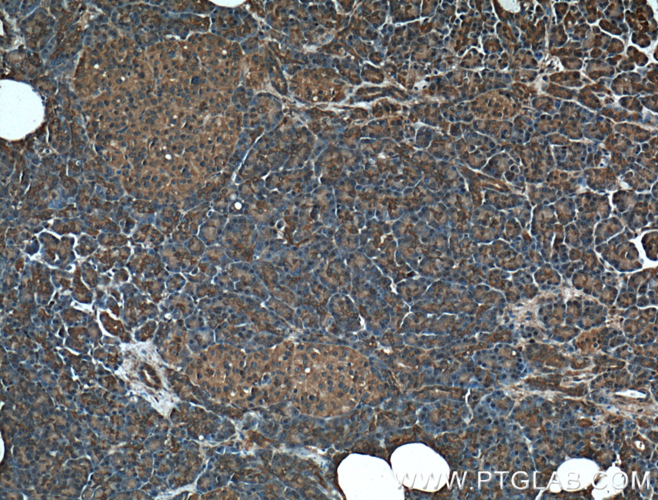 Immunohistochemistry (IHC) staining of human pancreas tissue using MGEA5 Polyclonal antibody (14711-1-AP)