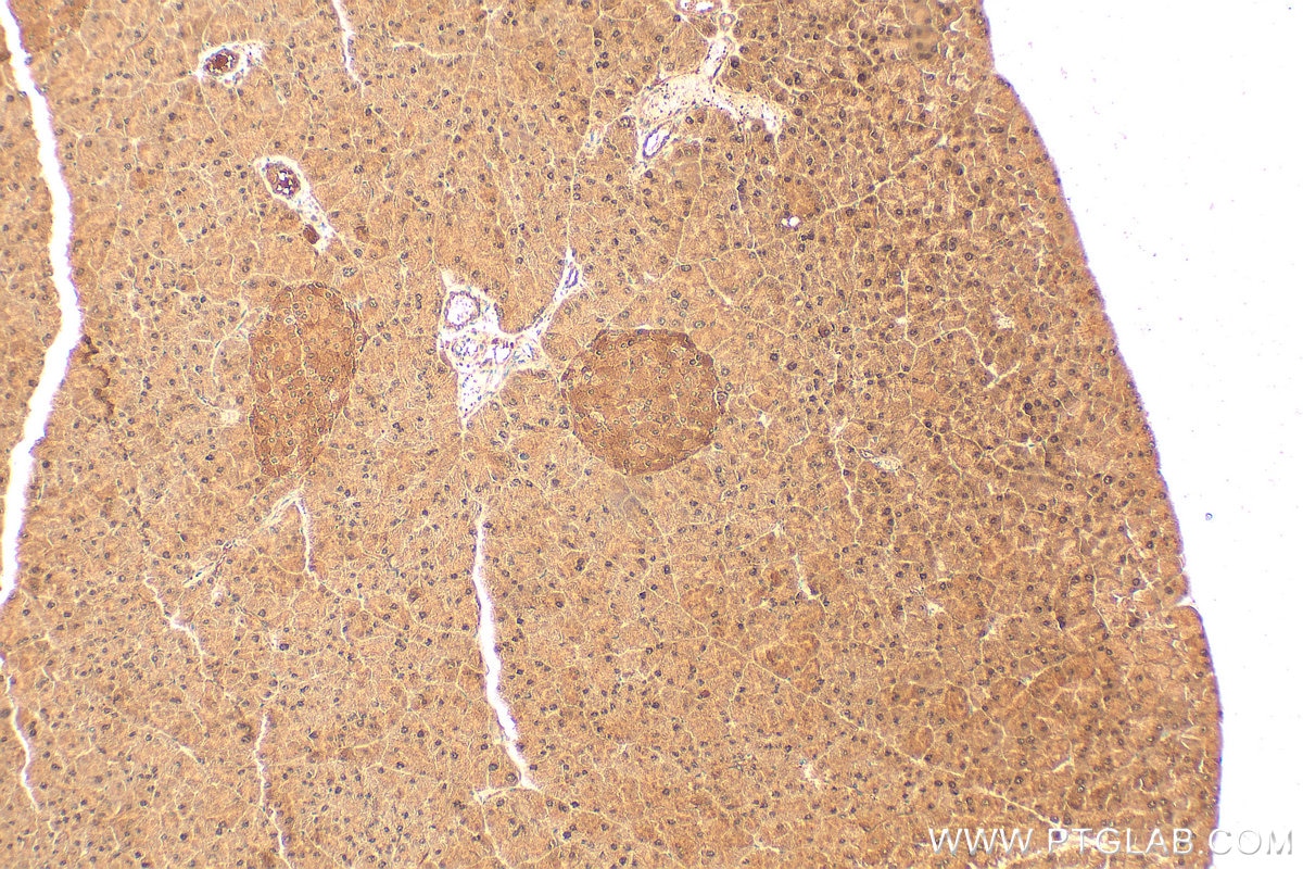 Immunohistochemistry (IHC) staining of mouse pancreas tissue using MGEA5 Polyclonal antibody (14711-1-AP)