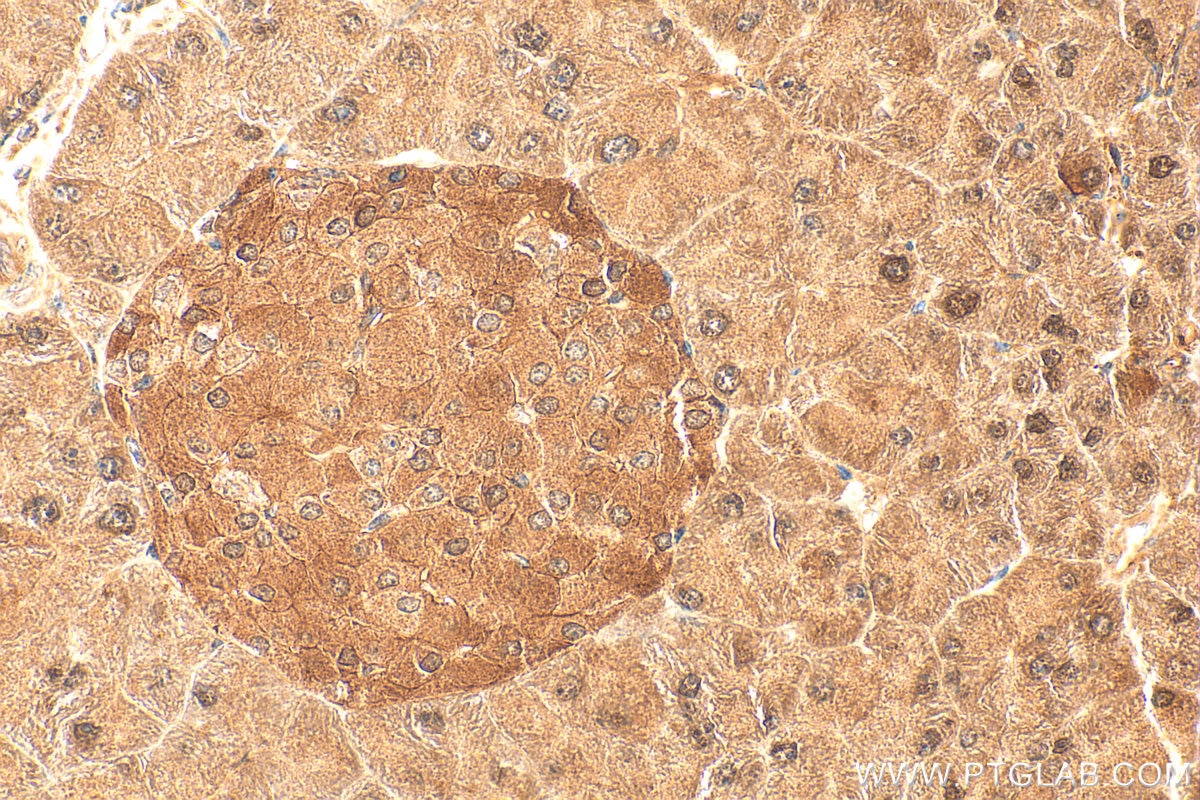 Immunohistochemistry (IHC) staining of mouse pancreas tissue using MGEA5 Polyclonal antibody (14711-1-AP)
