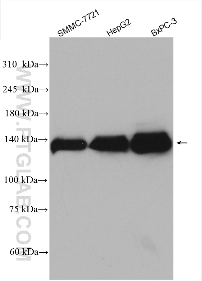 Western Blot (WB) analysis of various lysates using MGEA5 Polyclonal antibody (14711-1-AP)