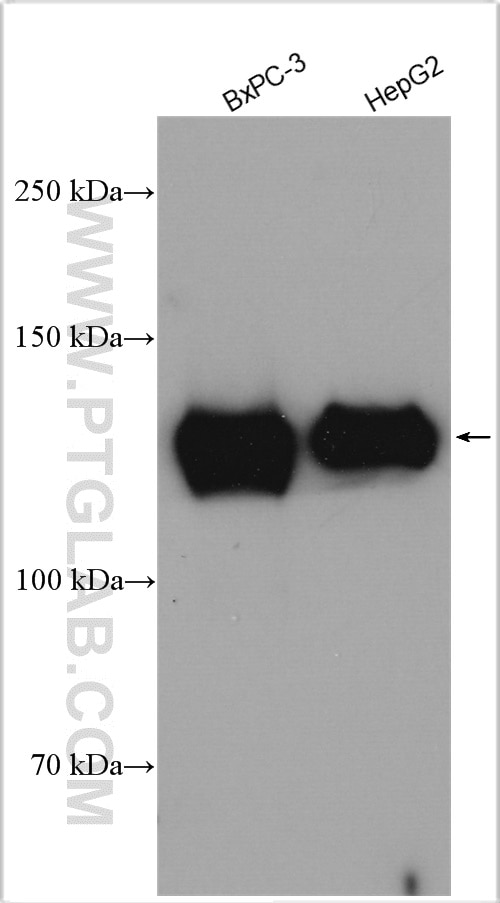 Western Blot (WB) analysis of various lysates using MGEA5 Polyclonal antibody (14711-1-AP)