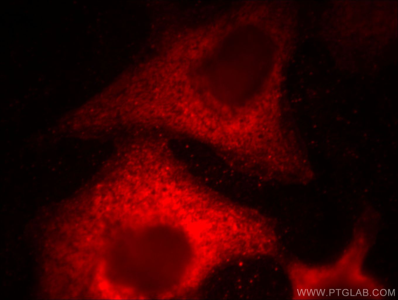 Immunofluorescence (IF) / fluorescent staining of HeLa cells using MGEA5 Monoclonal antibody (66033-1-Ig)