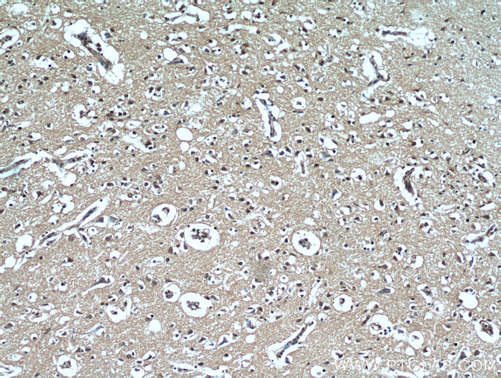 Immunohistochemistry (IHC) staining of human brain tissue using MGEA5 Monoclonal antibody (66033-1-Ig)