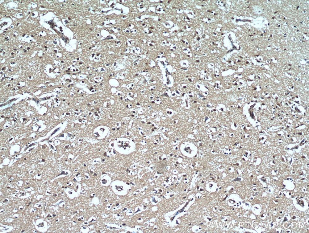 IHC staining of human brain using 66033-1-Ig