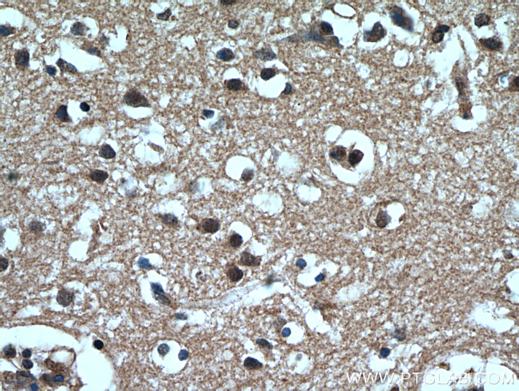 Immunohistochemistry (IHC) staining of human brain tissue using MGEA5 Monoclonal antibody (66033-1-Ig)