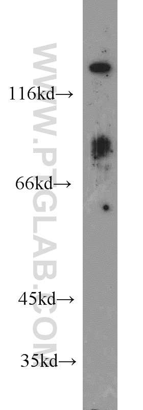 Western Blot (WB) analysis of Human brain tissue using MGEA5 Monoclonal antibody (66033-1-Ig)