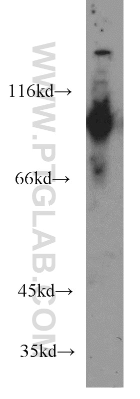 Western Blot (WB) analysis of human liver tissue using MGEA5 Monoclonal antibody (66033-1-Ig)