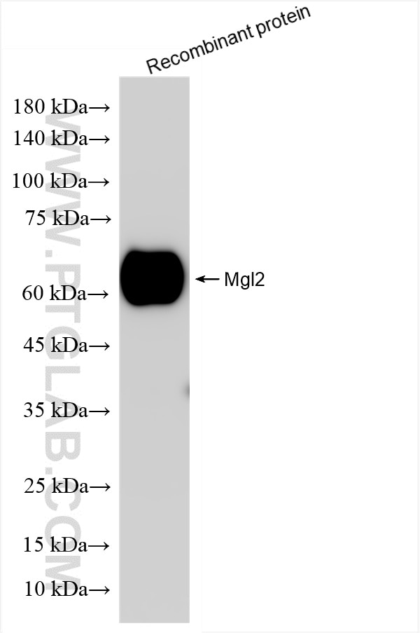 Western Blot (WB) analysis of various lysates using MGL2 Recombinant antibody (85876-1-RR)