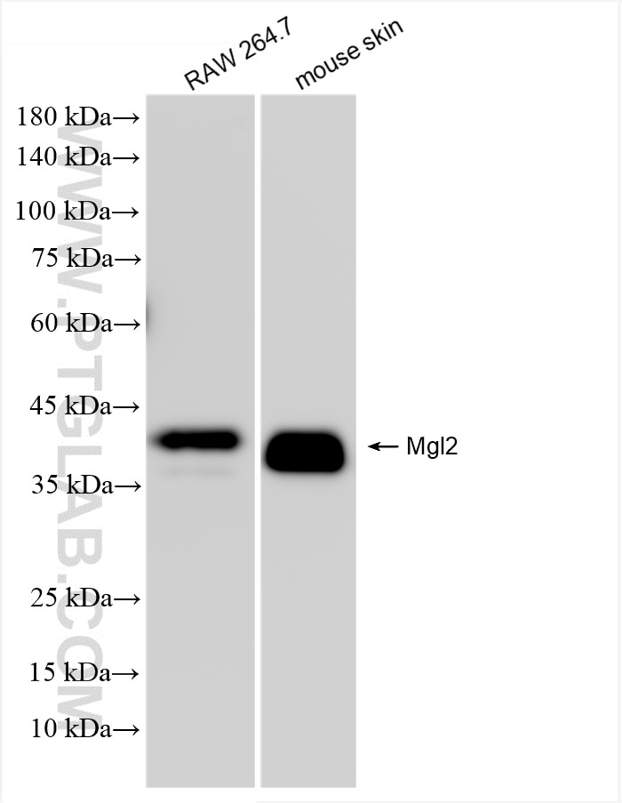 Western Blot (WB) analysis of various lysates using MGL2 Recombinant antibody (85876-1-RR)