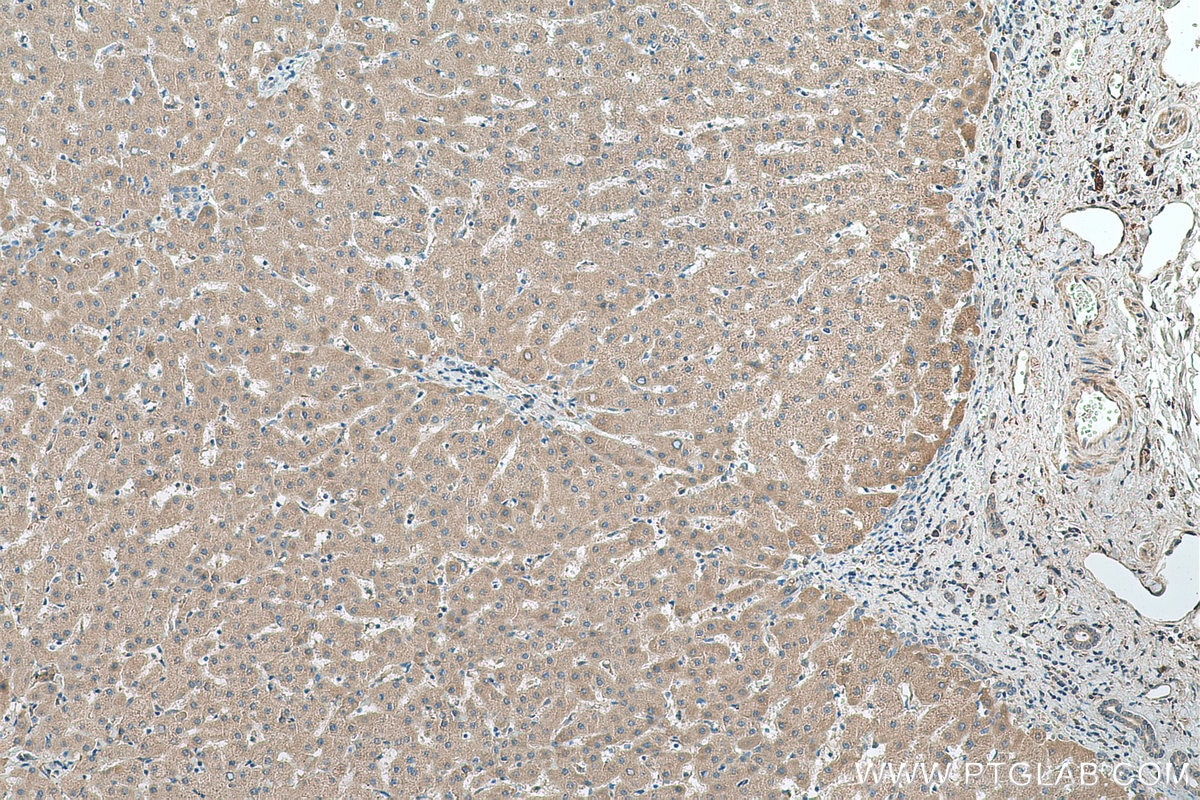 Immunohistochemistry (IHC) staining of human liver tissue using MGLL Polyclonal antibody (14986-1-AP)