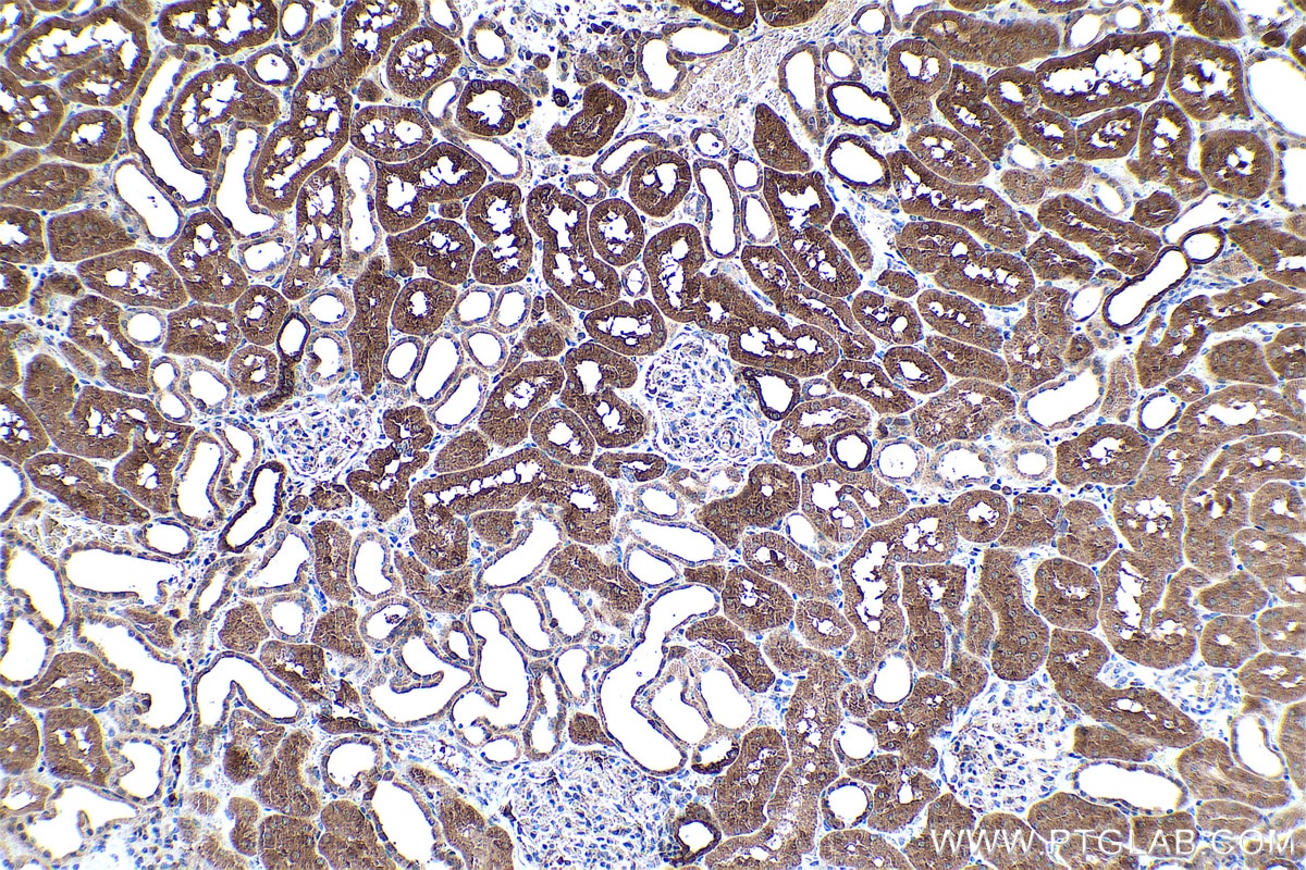 Immunohistochemistry (IHC) staining of human kidney tissue using MGLL Polyclonal antibody (14986-1-AP)