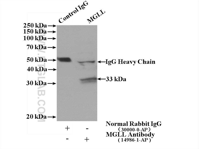 IP experiment of mouse liver using 14986-1-AP