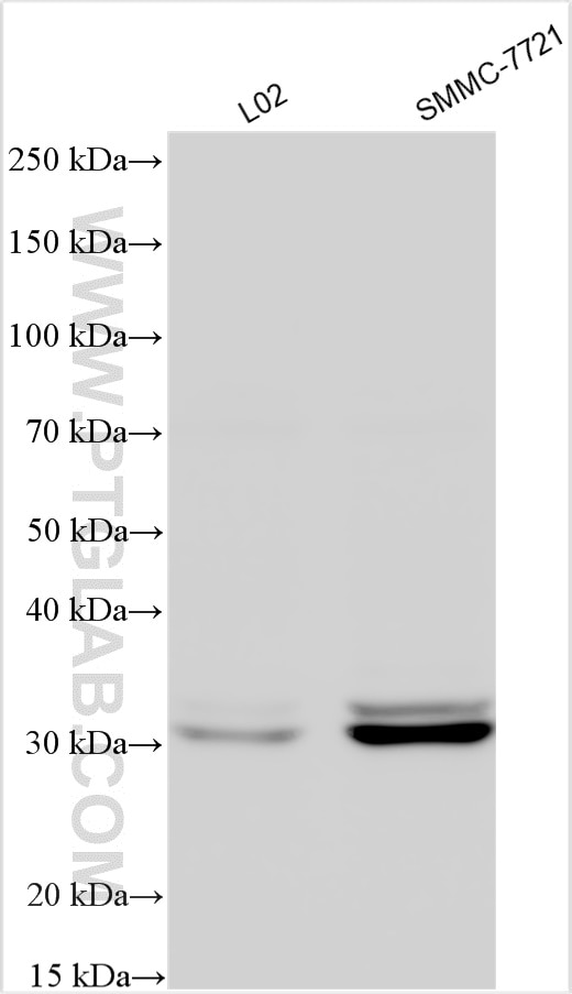 Western Blot (WB) analysis of various lysates using MGLL Polyclonal antibody (14986-1-AP)