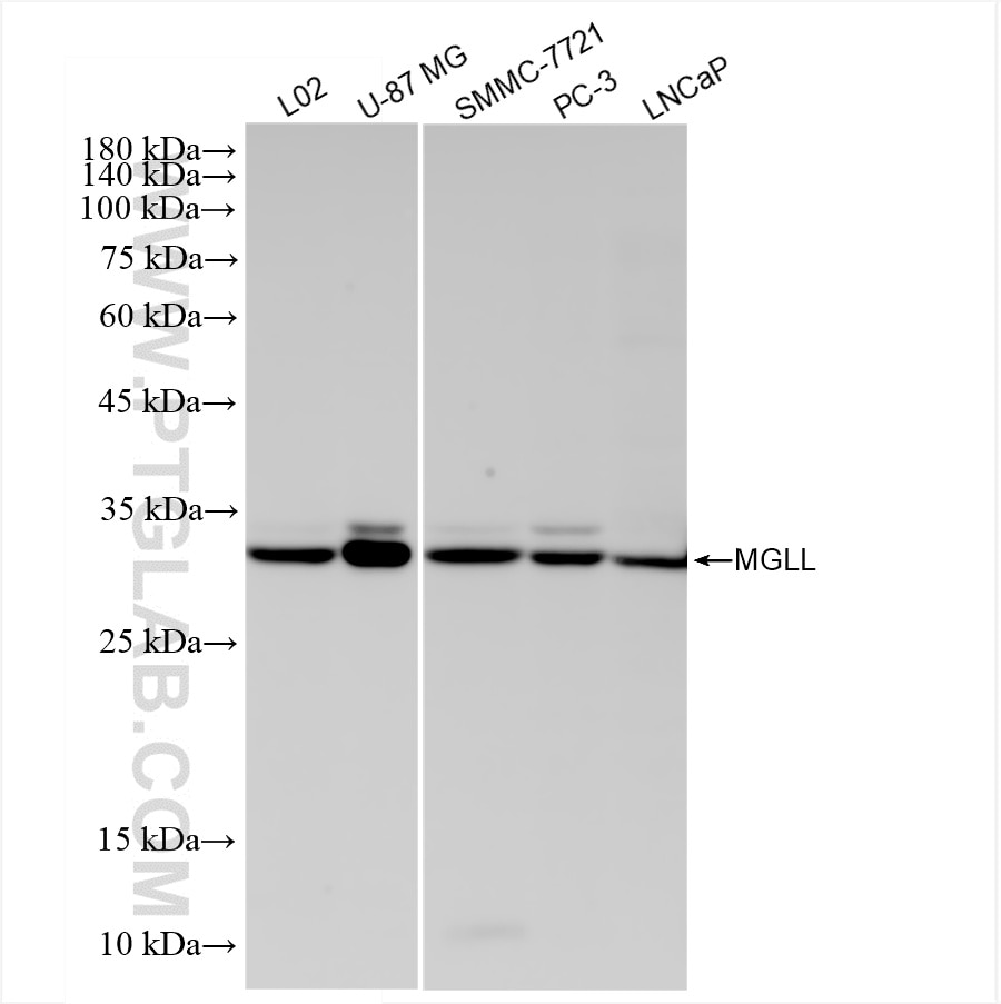 Western Blot (WB) analysis of various lysates using MGLL Recombinant antibody (86087-2-RR)