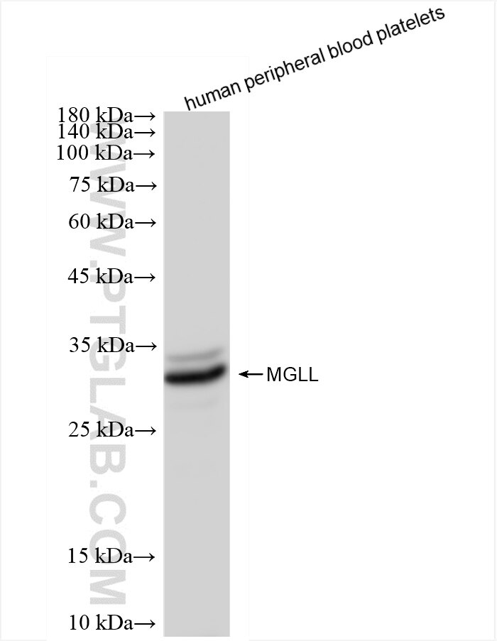 MGLL