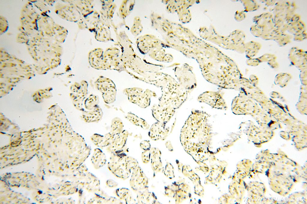 Immunohistochemistry (IHC) staining of human placenta tissue using MGMT Polyclonal antibody (17195-1-AP)