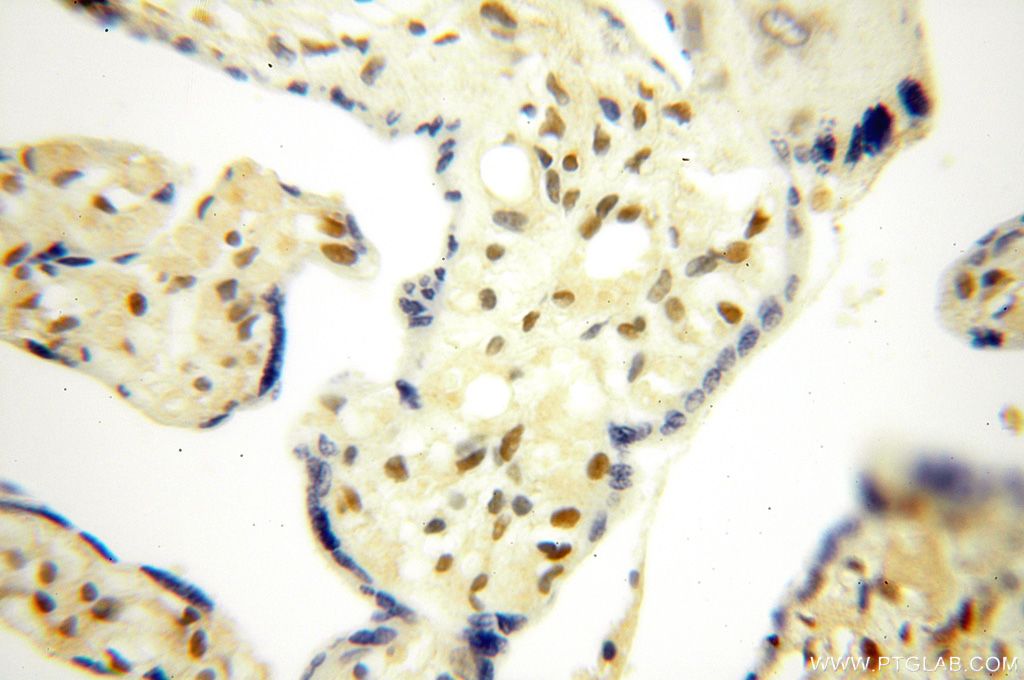 Immunohistochemistry (IHC) staining of human placenta tissue using MGMT Polyclonal antibody (17195-1-AP)