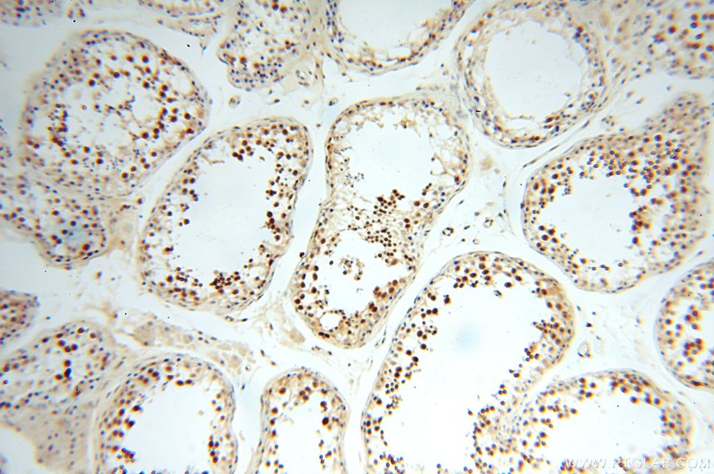 Immunohistochemistry (IHC) staining of human testis tissue using MGMT Polyclonal antibody (17195-1-AP)