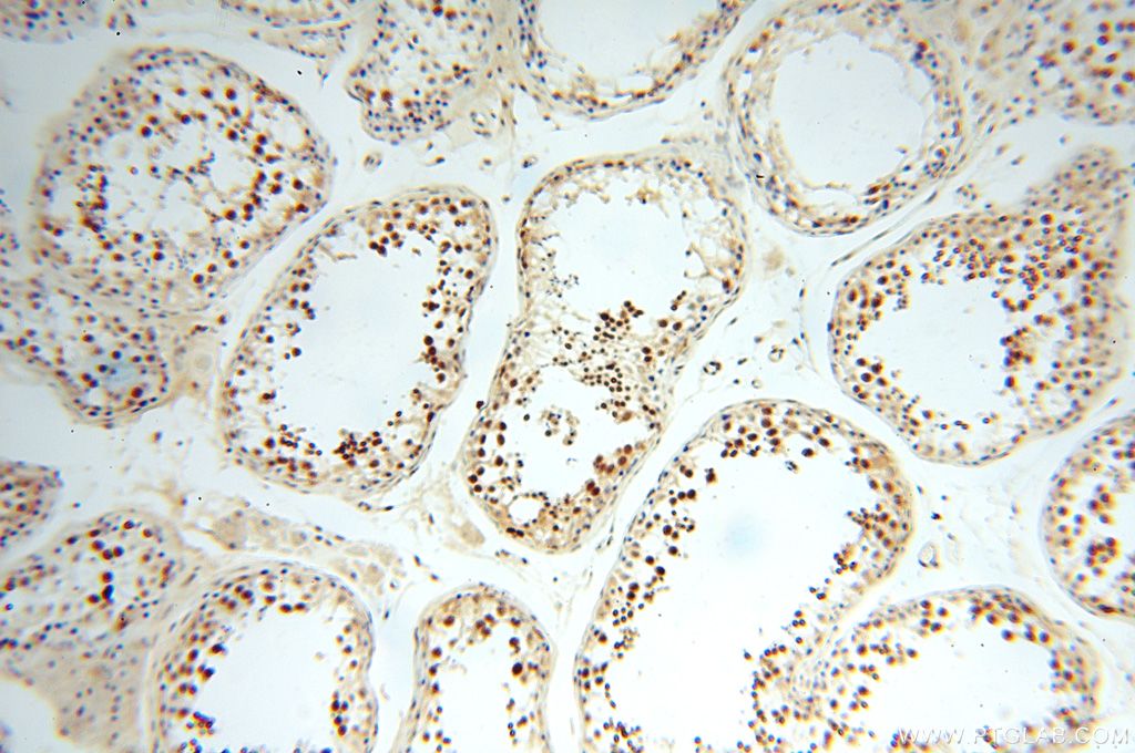 IHC staining of human testis using 17195-1-AP