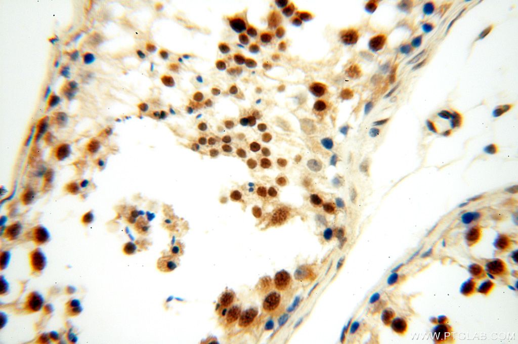 Immunohistochemistry (IHC) staining of human testis tissue using MGMT Polyclonal antibody (17195-1-AP)