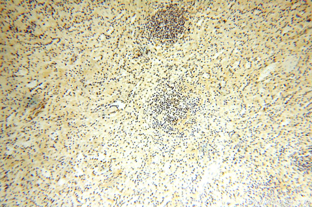 Immunohistochemistry (IHC) staining of human spleen tissue using MGMT Polyclonal antibody (17195-1-AP)