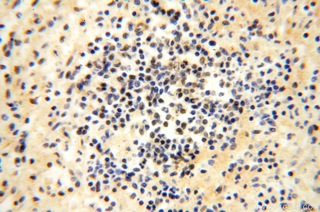 Immunohistochemistry (IHC) staining of human spleen tissue using MGMT Polyclonal antibody (17195-1-AP)