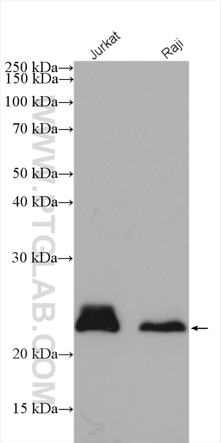 Western Blot (WB) analysis of various lysates using MGMT Polyclonal antibody (17195-1-AP)