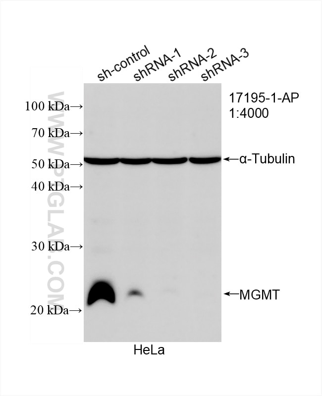 Western Blot (WB) analysis of HeLa cells using MGMT Polyclonal antibody (17195-1-AP)