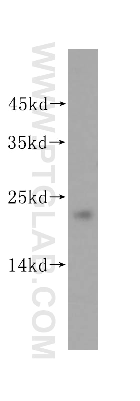 Western Blot (WB) analysis of Jurkat cells using MGMT Polyclonal antibody (17195-1-AP)