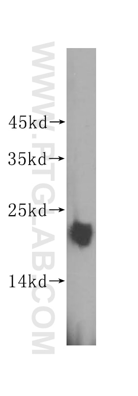 Western Blot (WB) analysis of MCF-7 cells using MGMT Polyclonal antibody (17195-1-AP)
