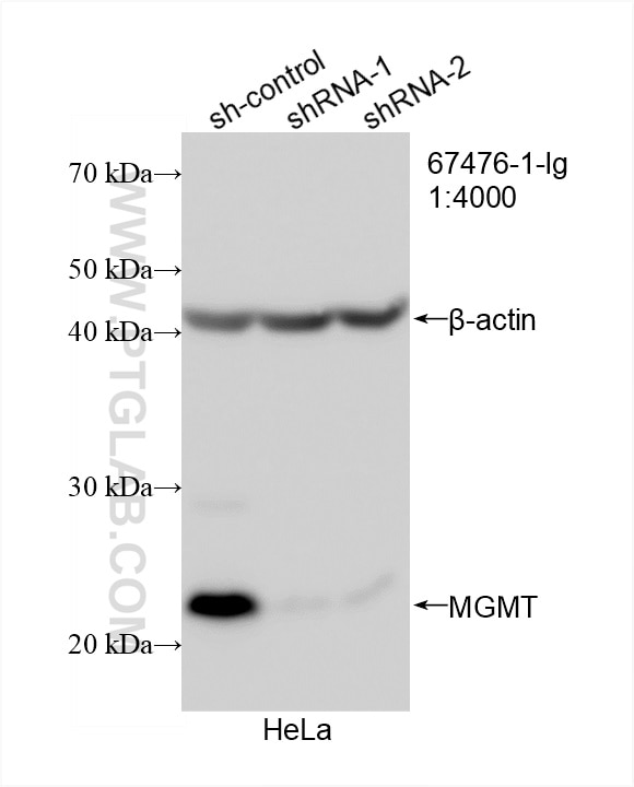 Western Blot (WB) analysis of HeLa cells using MGMT Monoclonal antibody (67476-1-Ig)