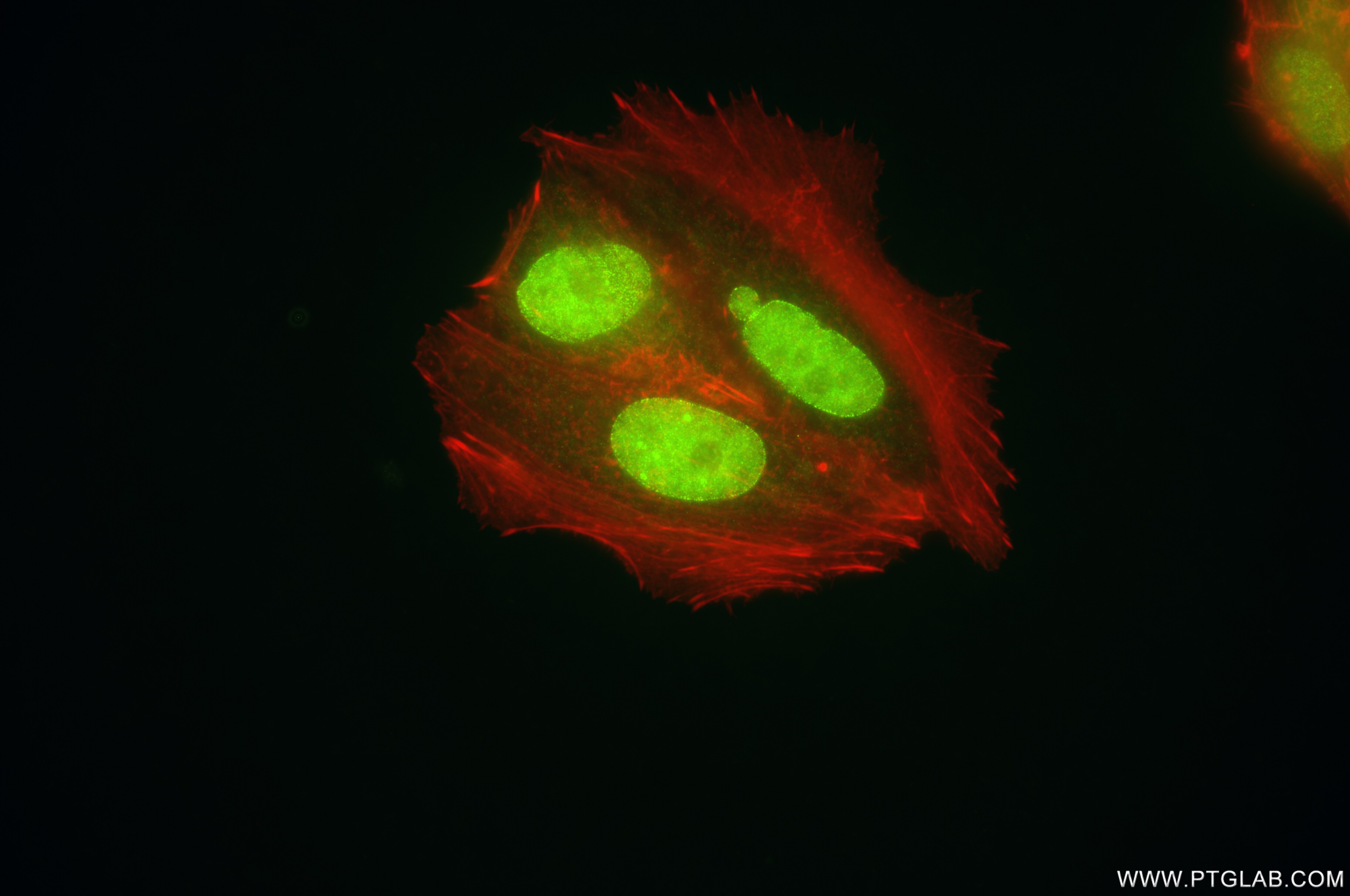 Immunofluorescence (IF) / fluorescent staining of MCF-7 cells using MGMT Recombinant antibody (86115-5-RR)