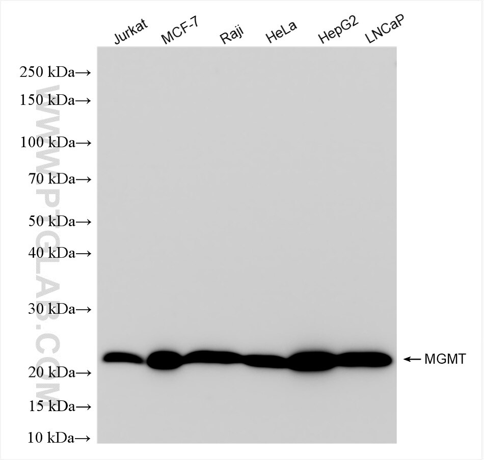 Western Blot (WB) analysis of various lysates using MGMT Recombinant antibody (86115-5-RR)