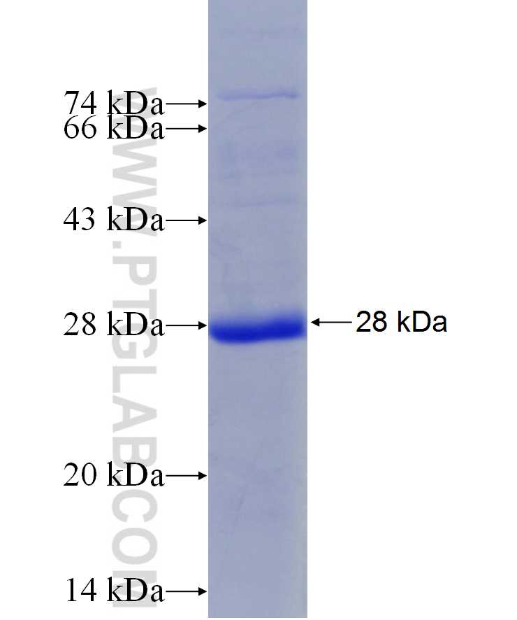 MGMT fusion protein Ag29936 SDS-PAGE