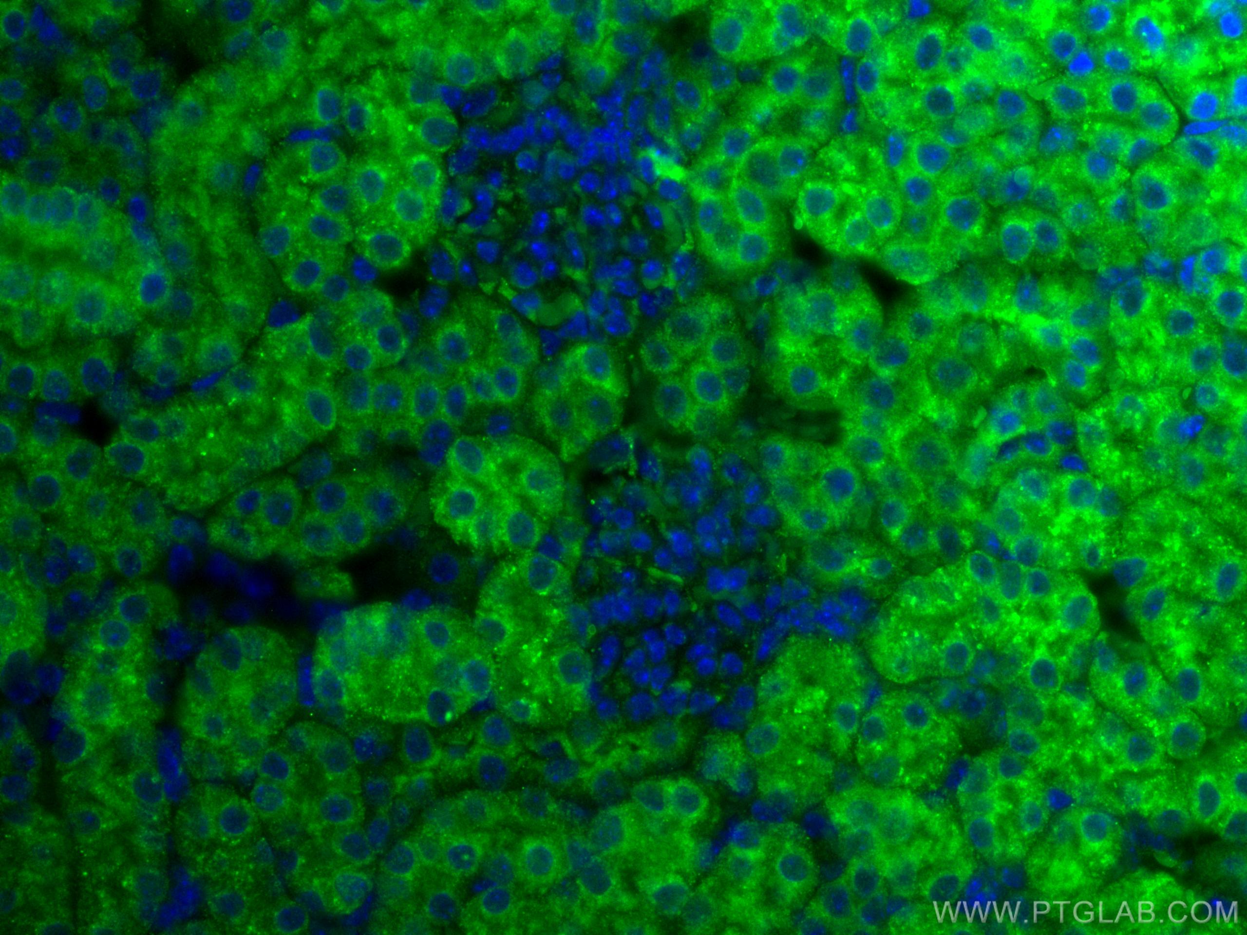 Immunofluorescence (IF) / fluorescent staining of mouse kidney tissue using MGP Polyclonal antibody (10734-1-AP)