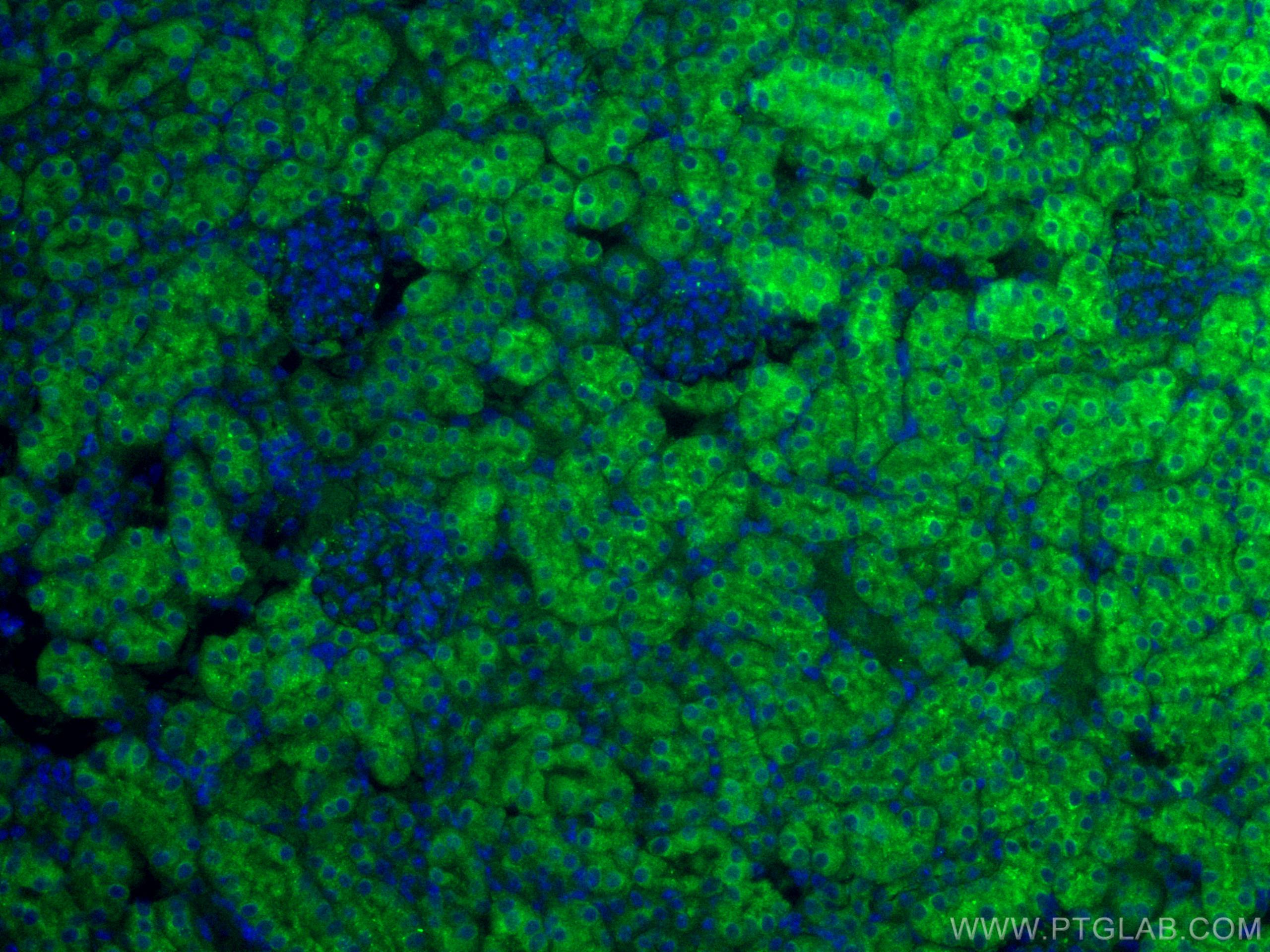 Immunofluorescence (IF) / fluorescent staining of mouse kidney tissue using MGP Polyclonal antibody (10734-1-AP)