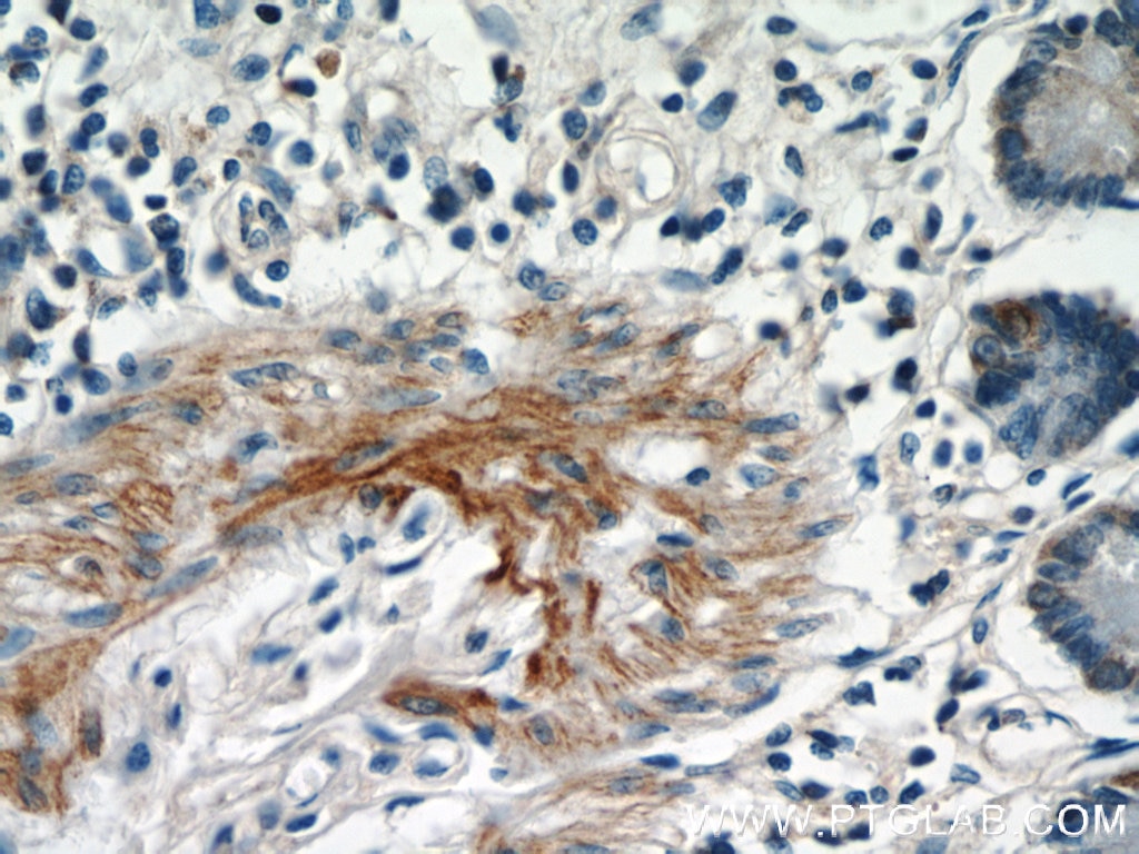 MGP Polyclonal antibody