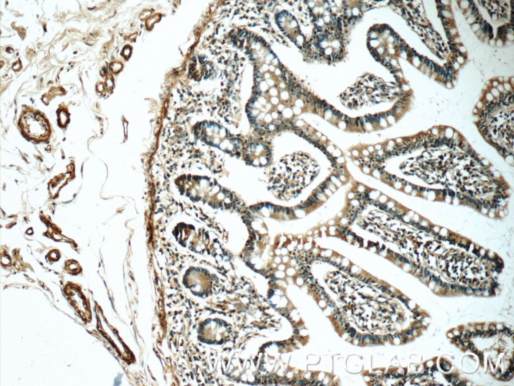 Immunohistochemistry (IHC) staining of human small intestine tissue using MGP Polyclonal antibody (10734-1-AP)