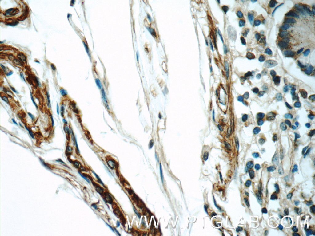 IHC staining of human small intestine using 10734-1-AP