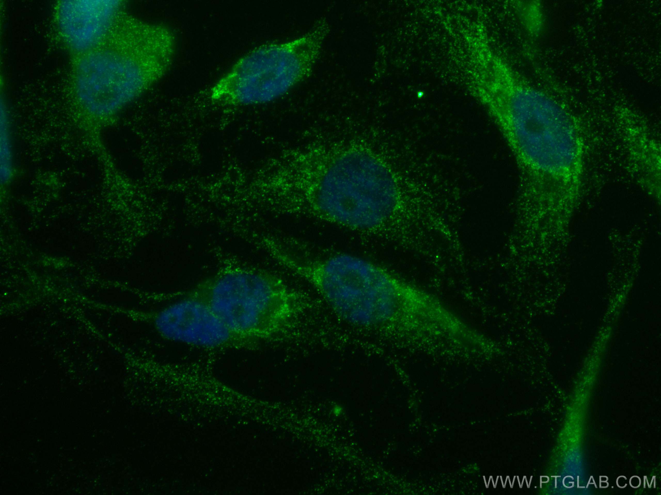 Immunofluorescence (IF) / fluorescent staining of MDA-MB-231 cells using MGP Monoclonal antibody (60055-1-Ig)