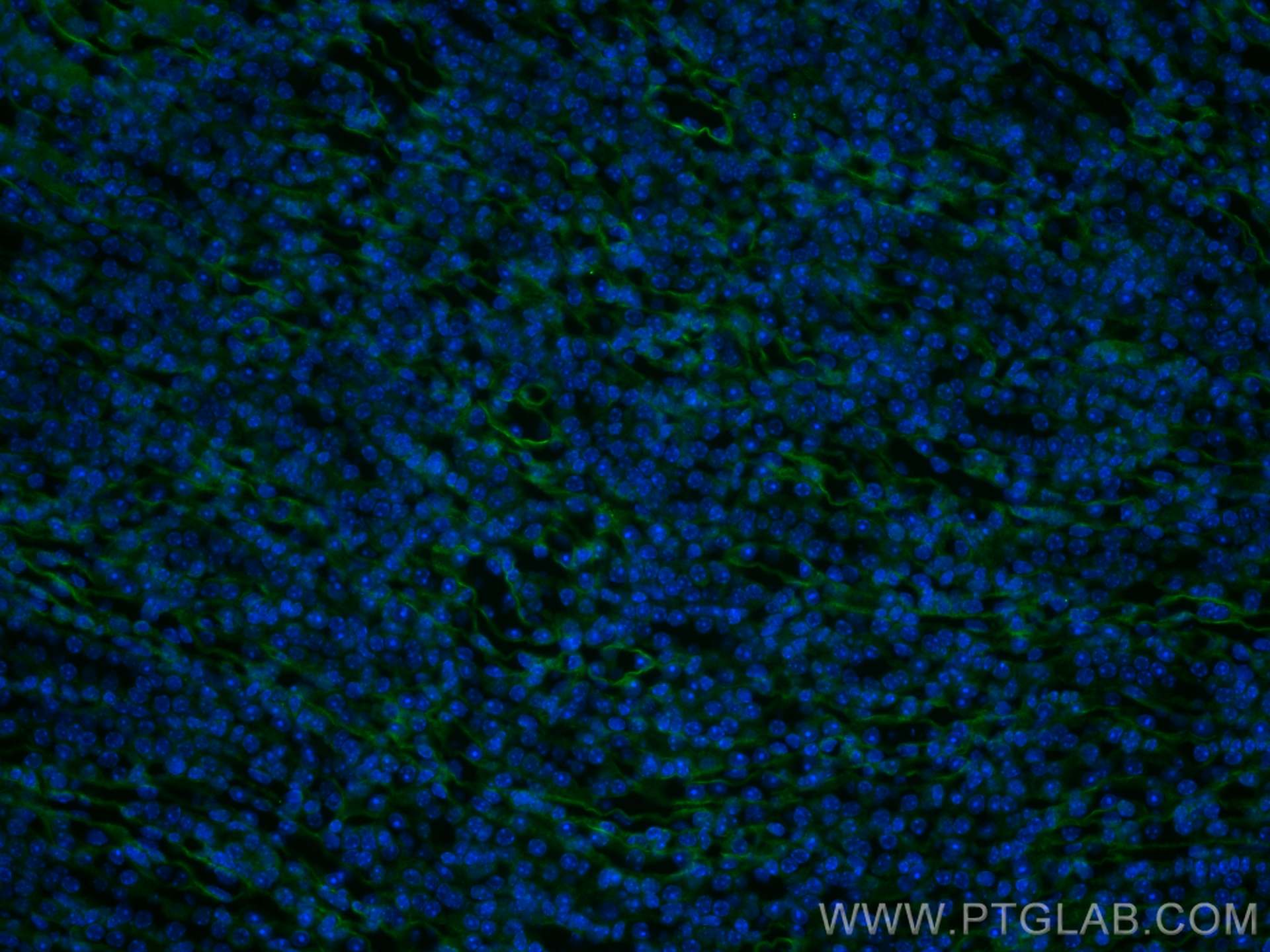 Immunofluorescence (IF) / fluorescent staining of mouse kidney tissue using MGP Monoclonal antibody (60055-1-Ig)
