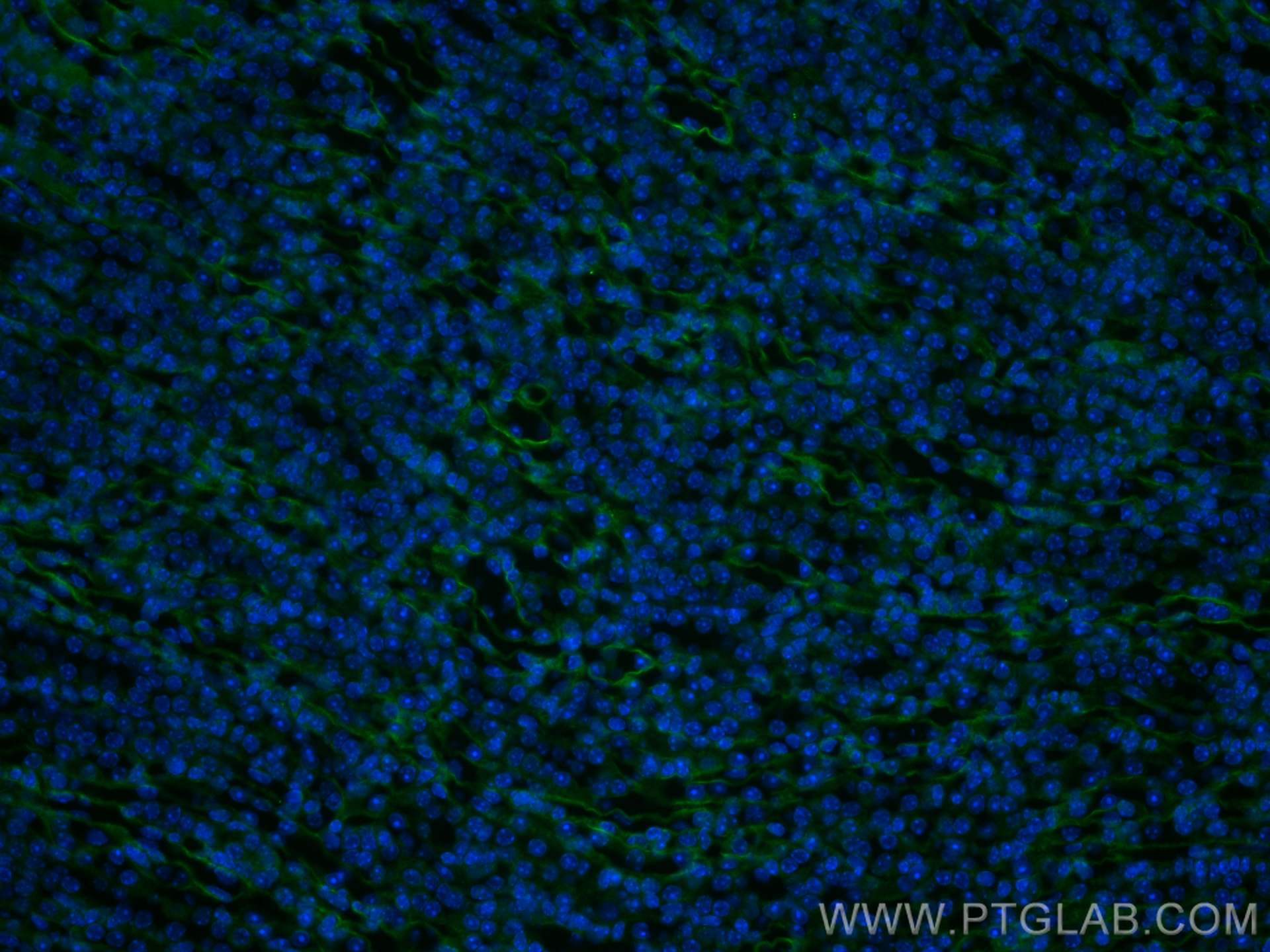 IF Staining of mouse kidney using 60055-1-Ig