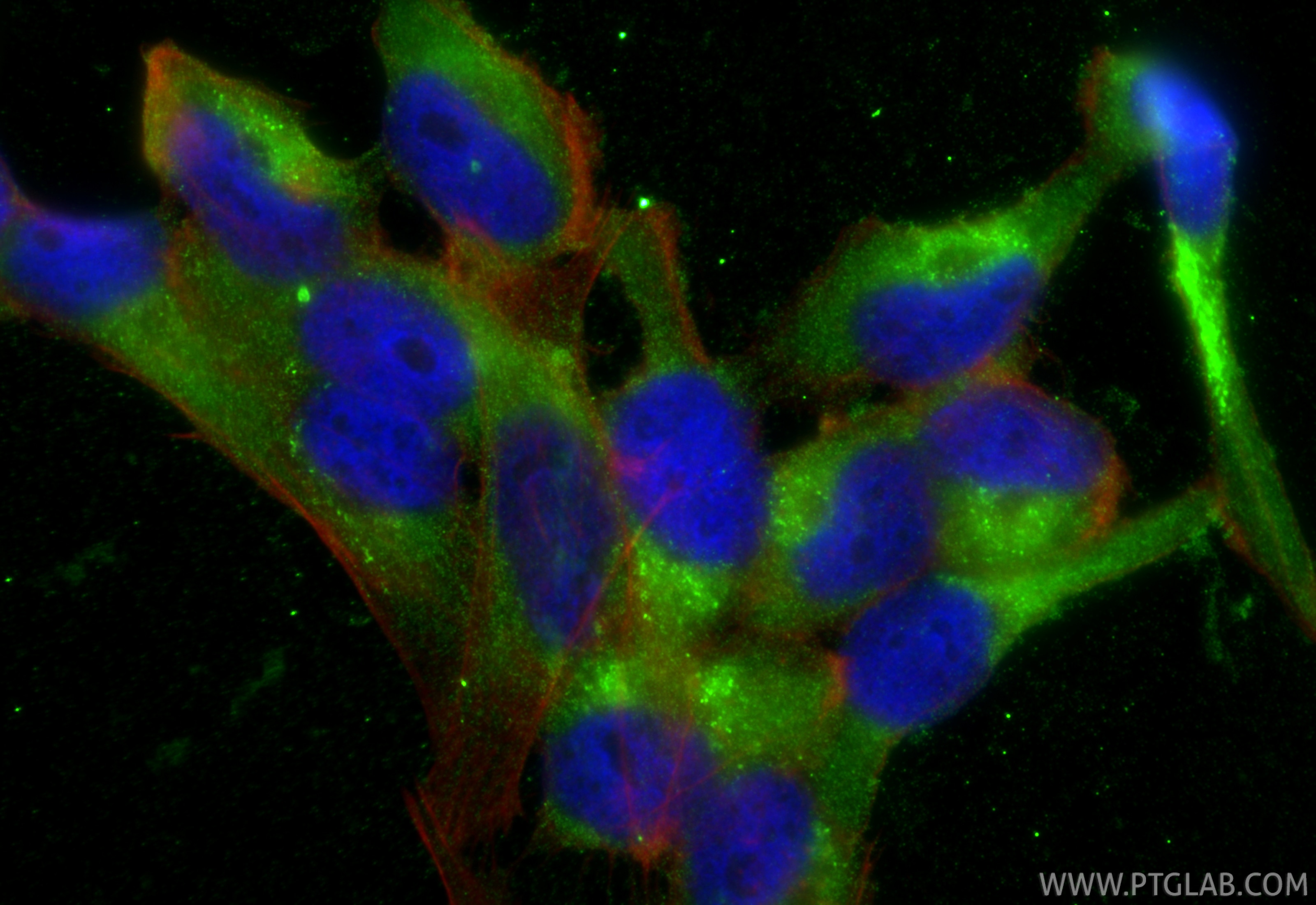 Immunofluorescent analysis of (-20°C Ethanol) fixed AC16 cells using MGP antibody (60055-1-Ig, Clone: 1A1C3 ) at dilution of 1:400 and CoraLite®488-Conjugated Goat Anti-Mouse IgG(H+L) (SA00013-1), CL594-Phalloidin (red). Immunofluorescence (IF) / fluorescent staining of AC16 cells using MGP Monoclonal antibody (60055-1-Ig)