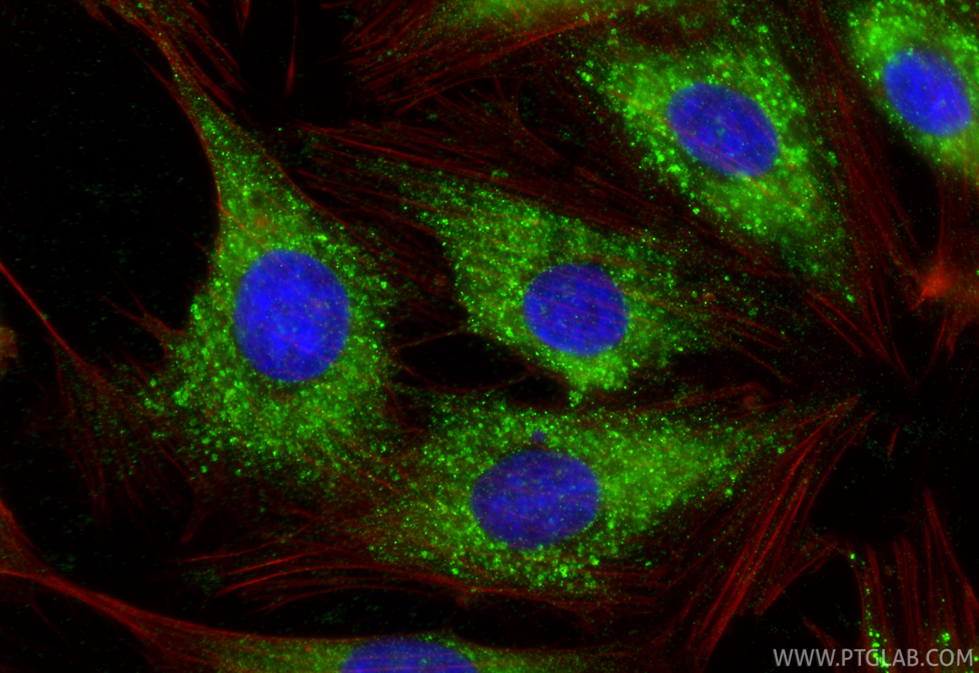 Immunofluorescent analysis of (-20°C Ethanol) fixed H9C2 cells using MGP antibody (60055-1-Ig, Clone: 1A1C3 ) at dilution of 1:400 and CoraLite®488-Conjugated Goat Anti-Mouse IgG(H+L) (SA00013-1), CL594-Phalloidin (red). Immunofluorescence (IF) / fluorescent staining of H9C2 cells using MGP Monoclonal antibody (60055-1-Ig)