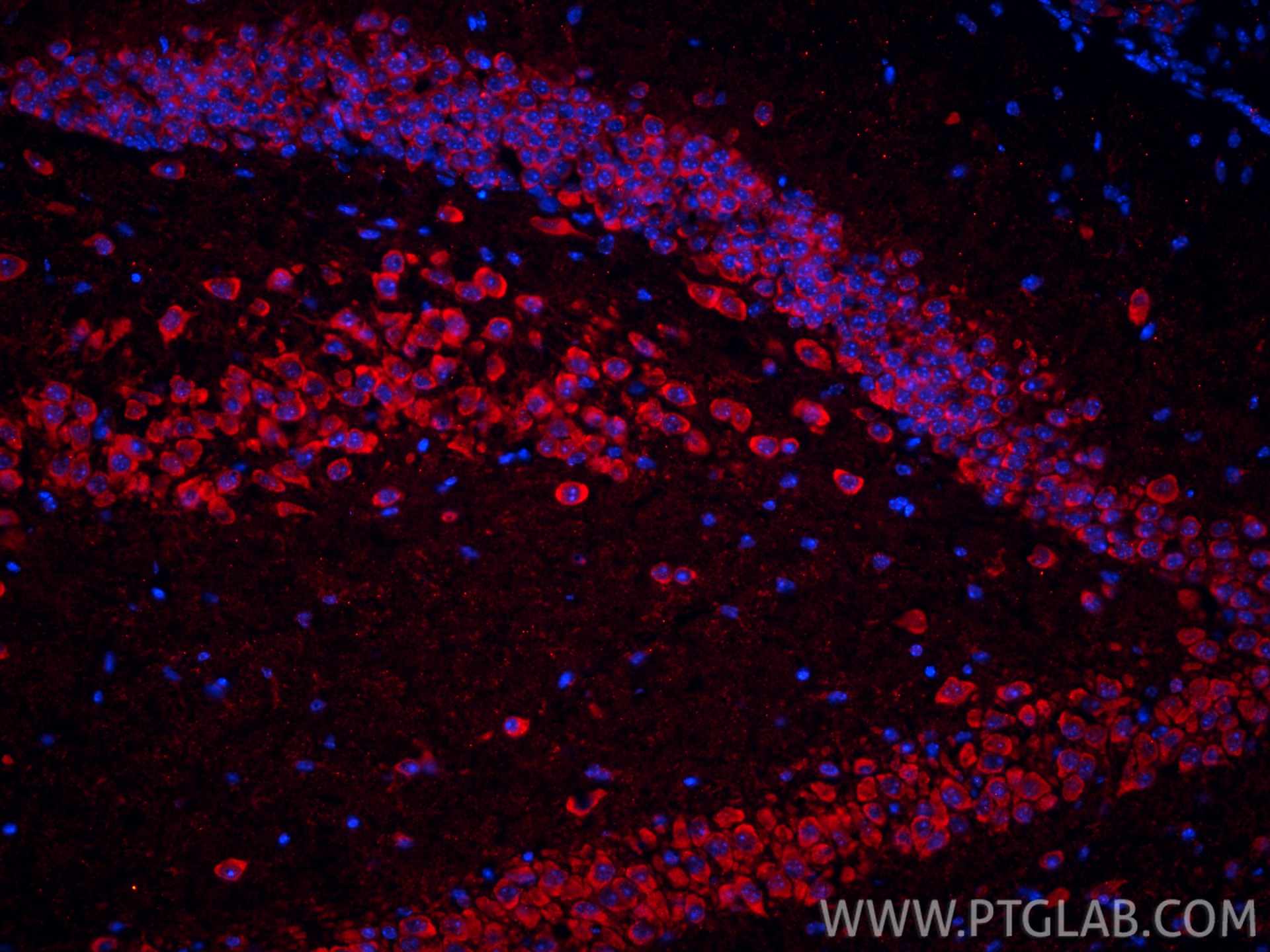 Immunofluorescent analysis of (4% PFA) fixed frozen OCT-embedded mouse brain tissue using MGP antibody (60055-1-Ig, Clone: 1A1C3 ) at dilution of 1:800 and CoraLite®594-Conjugated Goat Anti-Mouse IgG(H+L) (SA00013-3). Immunofluorescence (IF) / fluorescent staining of mouse brain tissue using MGP Monoclonal antibody (60055-1-Ig)