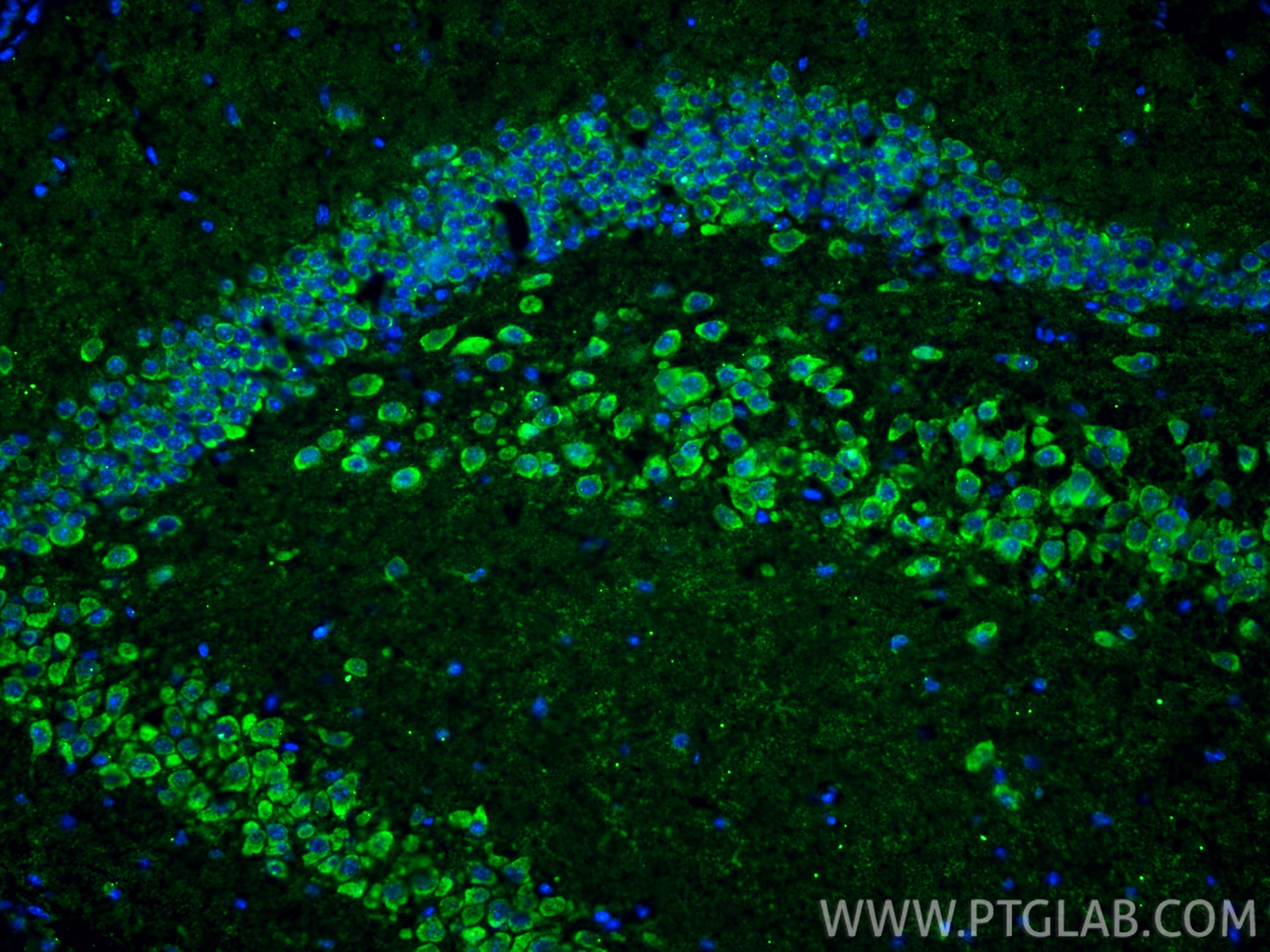 Immunofluorescent analysis of (4% PFA) fixed frozen OCT-embedded mouse brain tissue using MGP antibody (60055-1-Ig, Clone: 1A1C3 ) at dilution of 1:800 and CoraLite®488-Conjugated Goat Anti-Mouse IgG(H+L) (SA00013-1). Immunofluorescence (IF) / fluorescent staining of mouse brain tissue using MGP Monoclonal antibody (60055-1-Ig)