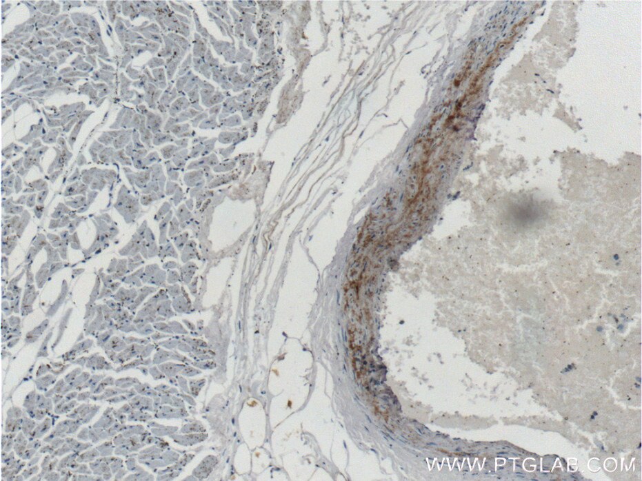 Immunohistochemistry (IHC) staining of human heart tissue using MGP Monoclonal antibody (60055-1-Ig)